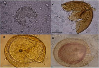 Selecting Native Arbuscular Mycorrhizal Fungi to Promote Cassava Growth and Increase Yield under Field Conditions